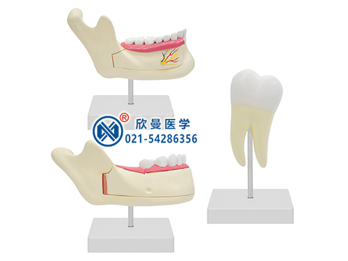 磨牙、乳牙、恒牙模型