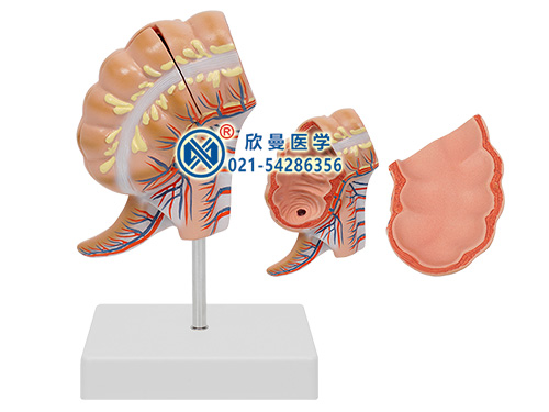 盲腸和闌尾模型